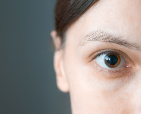 שאלות ותשובות על בדיקת עיניים עם הרחבת אישונים אצל ילדים